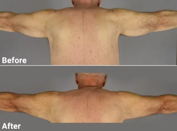 arm5