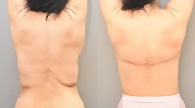 back3