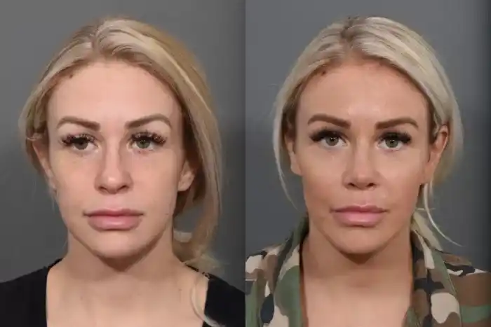 lip1