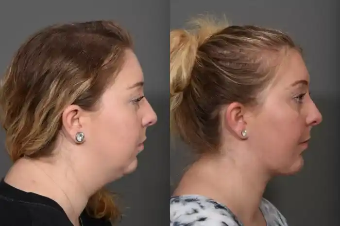 neck4